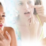 Acne-pimples