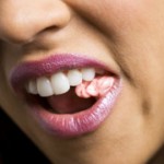 chewing-gum
